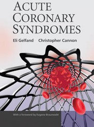 Management of Acute Coronary Syndromes