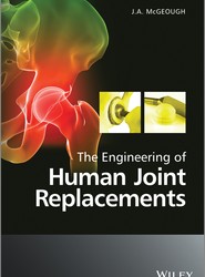 The Engineering of Human Joint Replacements