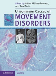 Uncommon Causes of Movement Disorders
