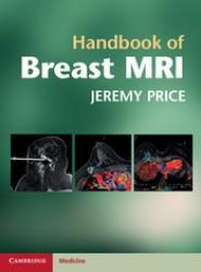 Handbook of Breast MRI