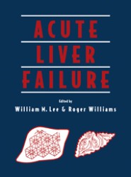 Acute Liver Failure
