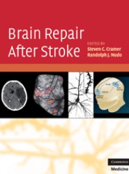 Brain Repair After Stroke