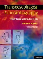 Transoesophageal Echocardiography