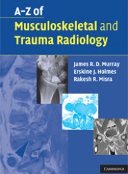 A-Z of Musculoskeletal and Trauma Radiology