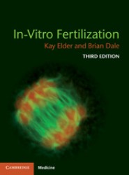 In-Vitro Fertilization  