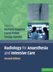 Radiology for Anaesthesia and Intensive Care