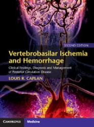 Vertebrobasilar Ischemia and Hemorrhage