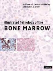 Illustrated Pathology of the Bone Marrow