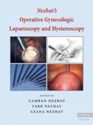 Nezhat's Operative Gynecologic Laparoscopy and Hysteroscopy