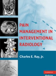 Pain Management in Interventional Radiology