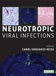 Neurotropic Viral Infections