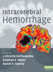 Intracerebral Hemorrhage