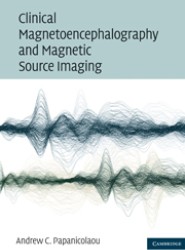 Clinical Magnetoencephalography and Magnetic Source Imaging