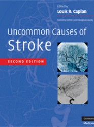 Uncommon Causes of Stroke