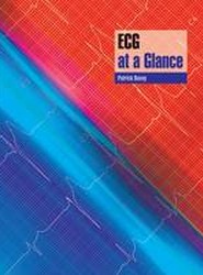 ECG at a Glance