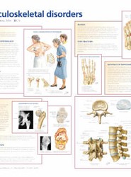 Frank H. Netter Musculoskeletal Disorders Poster