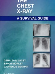 The Chest X-Ray: A Survival Guide