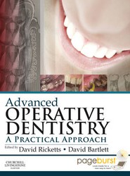 Advanced Operative Dentistry