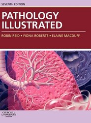 Pathology Illustrated