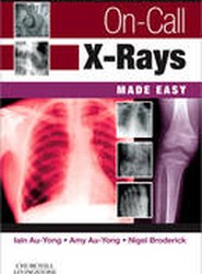 On-Call X-Rays Made Easy