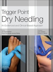 Trigger Point Dry Needling