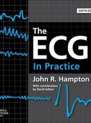 The ECG In Practice