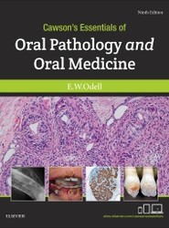 Cawson's Essentials of Oral Pathology and Oral Medicine