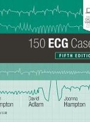 150 ECG Cases