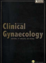 Clinical Gynaecology