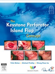 Design Concepts in Reconstructive Surgery