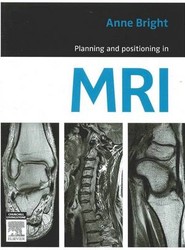 Planning and Positioning in MRI