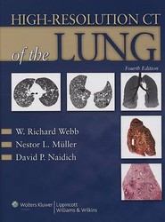 High-Resolution CT of the Lung