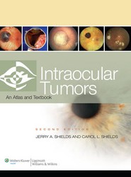 Intraocular Tumors