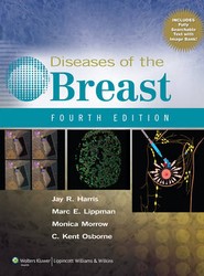 Diseases of the Breast