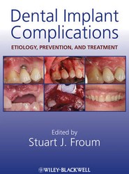 Dental Implant Complications