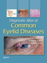 Diagnostic Atlas of Common Eyelid Diseases