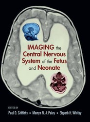 Imaging the Central Nervous System of the Fetus and Neonate