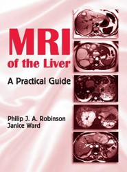 MRI of the Liver