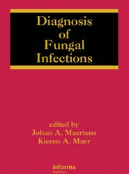 Diagnosis of Fungal Infections