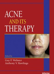 Acne and Its Therapy