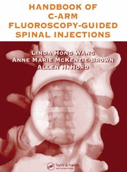 The Handbook of C-Arm Fluoroscopy-Guided Spinal Injections