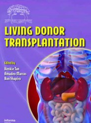 Living Donor Transplantation