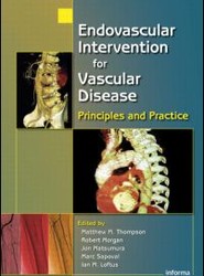 Endovascular Intervention for Vascular Disease