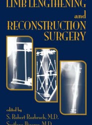 Limb Lengthening and Reconstruction Surgery