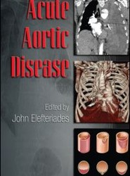 Acute Aortic Disease