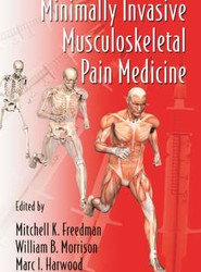 Minimally Invasive Musculoskeletal Pain Medicine