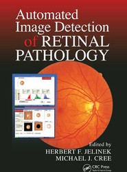 Automated Image Detection of Retinal Pathology