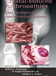 Crystal-Induced Arthropathies