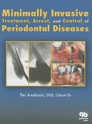 Minimally Invasive Treatment, Arrest, and Control of Periodontal Disease