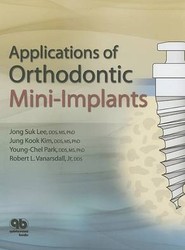 Applications of Orthodontic Mini Implants